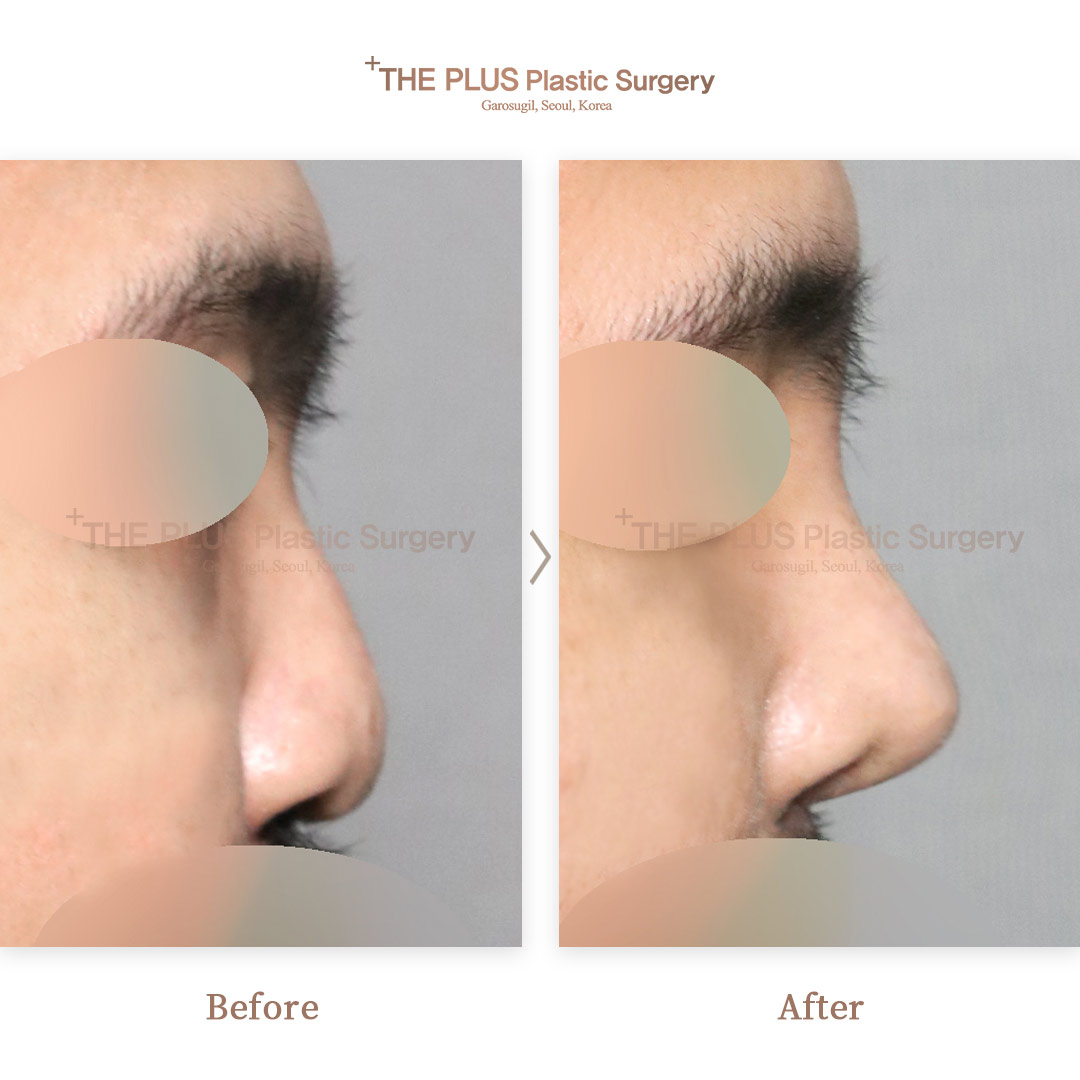 THE PLUS CLINIC KOREA -