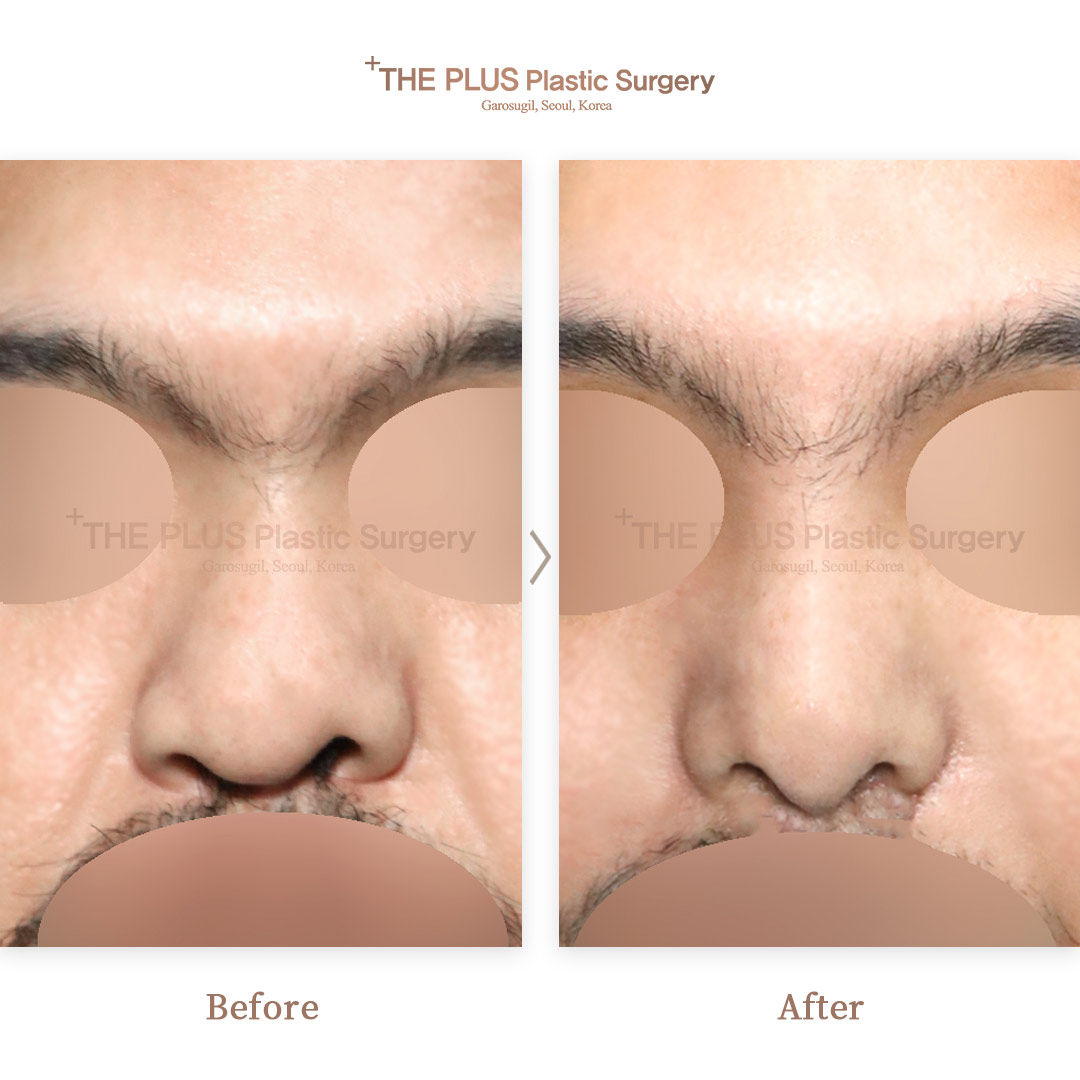 THE PLUS CLINIC KOREA -