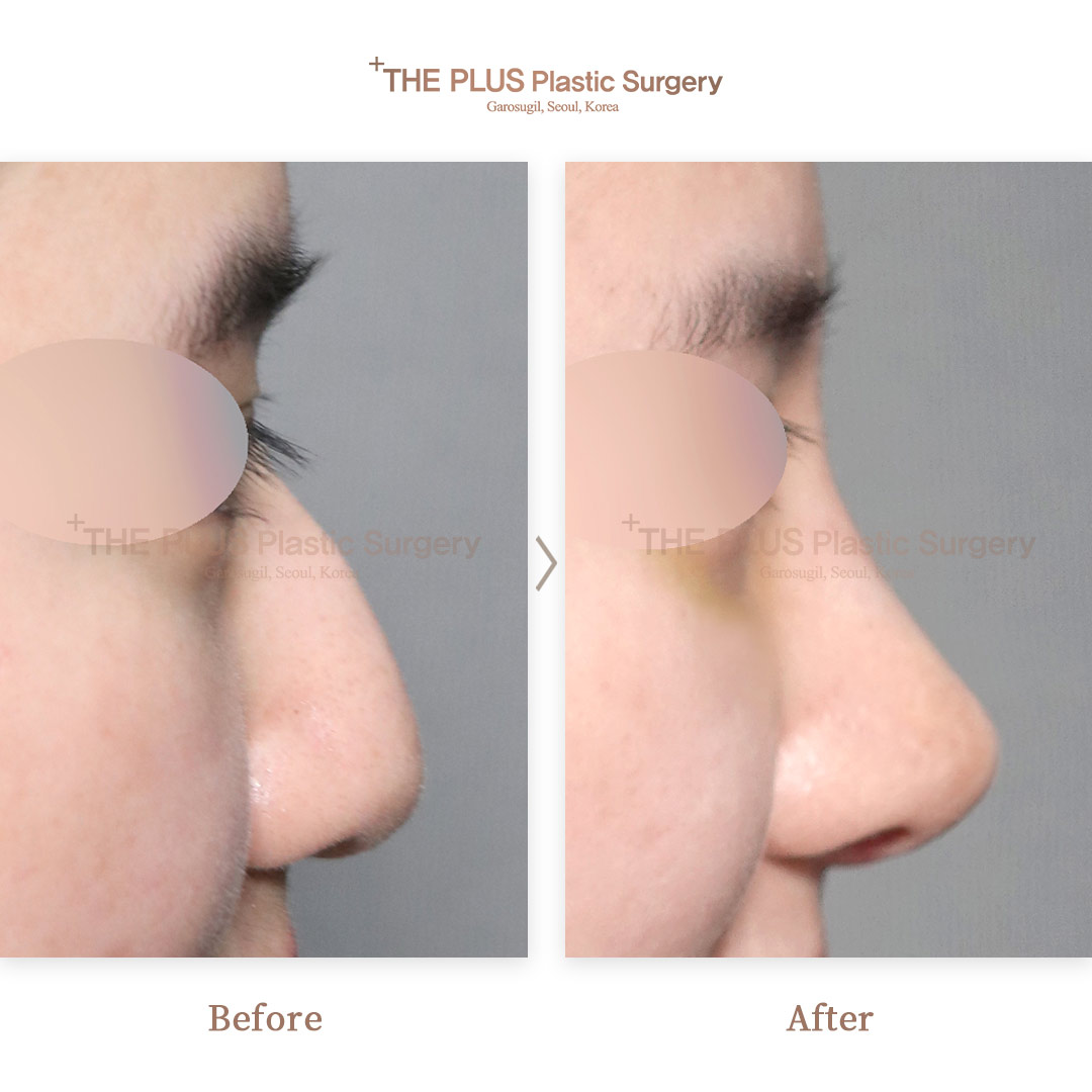 THE PLUS CLINIC KOREA -