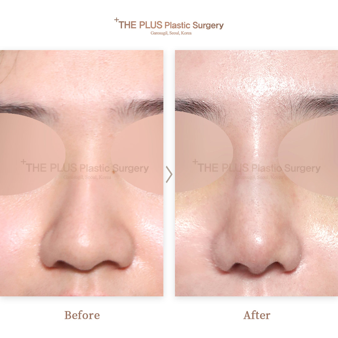 THE PLUS CLINIC KOREA -