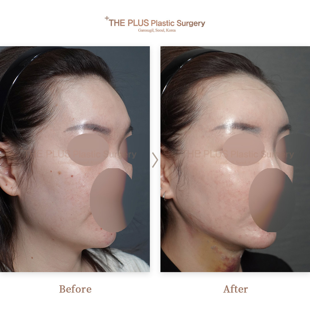 THE PLUS CLINIC KOREA -