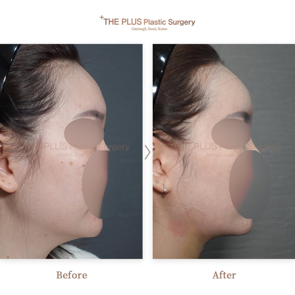 THE PLUS CLINIC KOREA -
