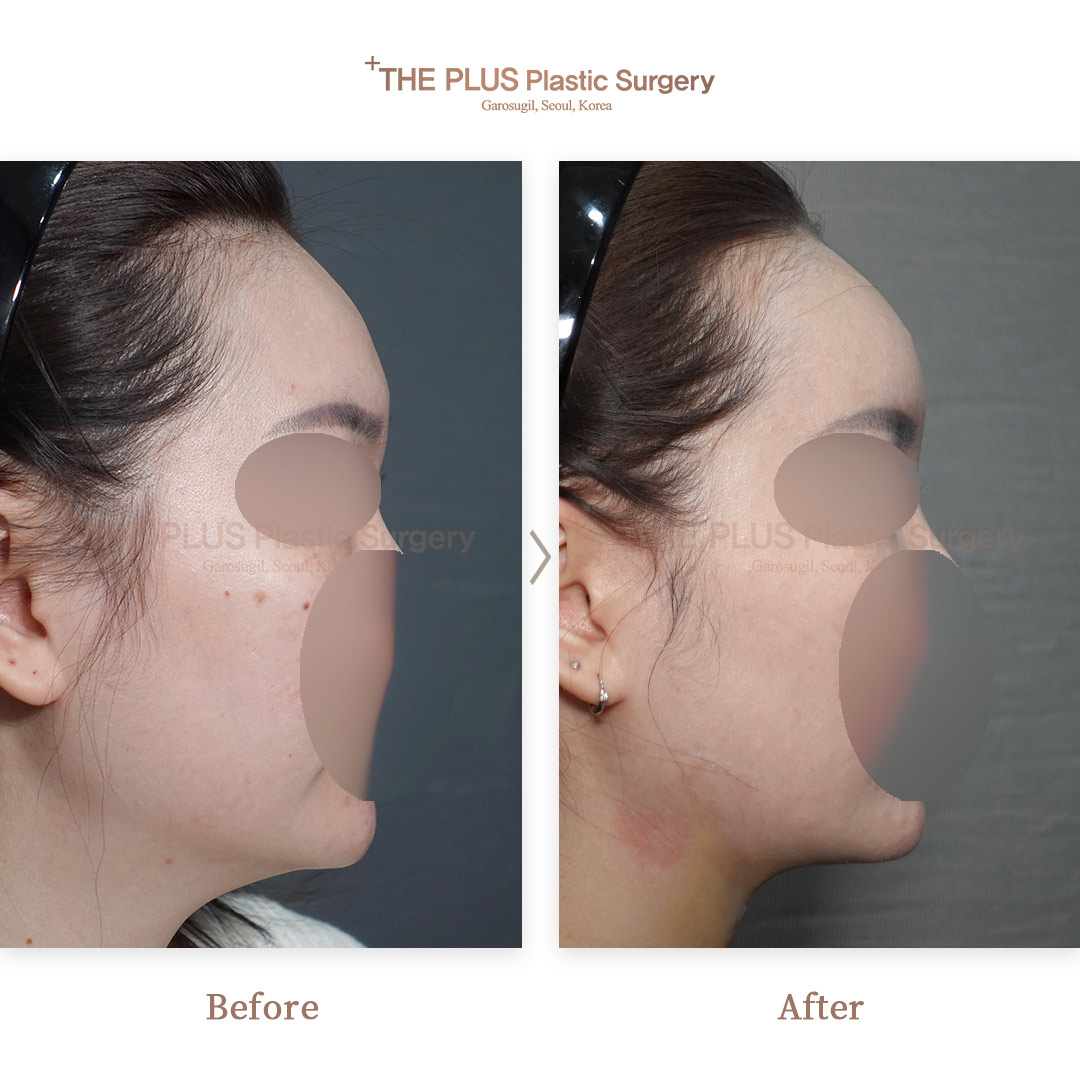 THE PLUS CLINIC KOREA -