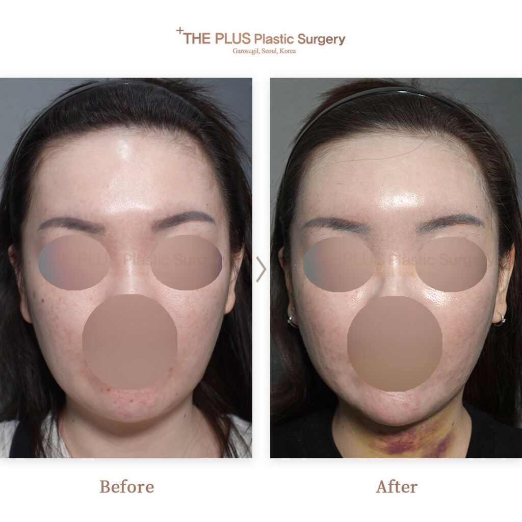 THE PLUS CLINIC KOREA -