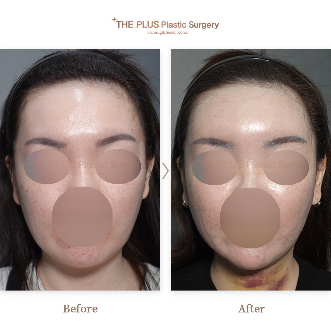 THE PLUS CLINIC KOREA -