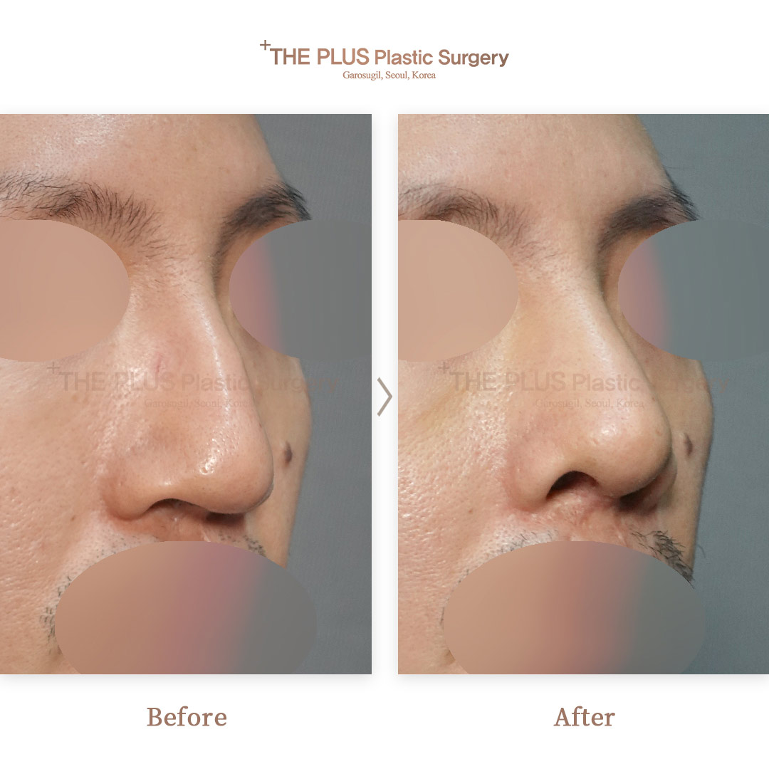 THE PLUS CLINIC KOREA -