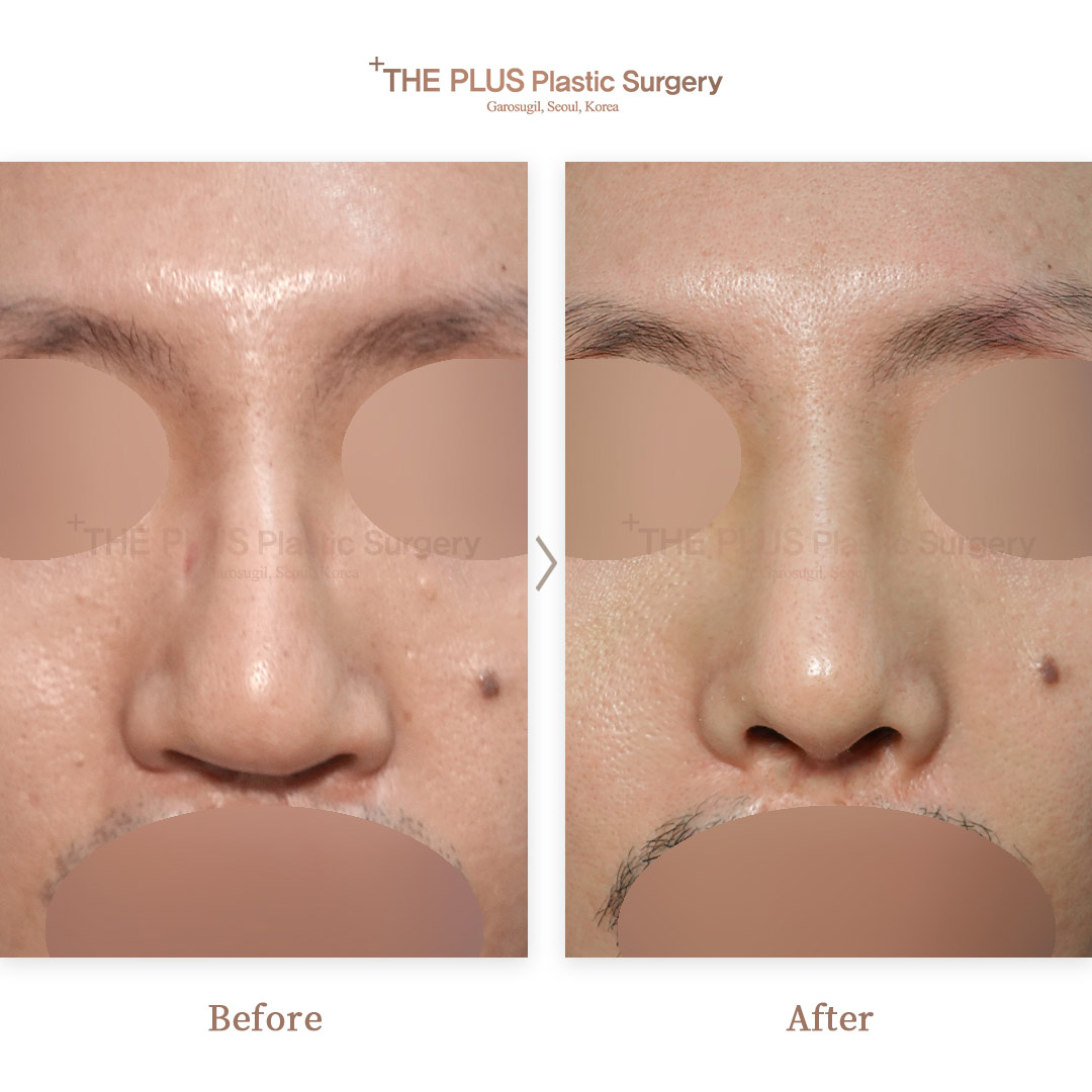 THE PLUS CLINIC KOREA -