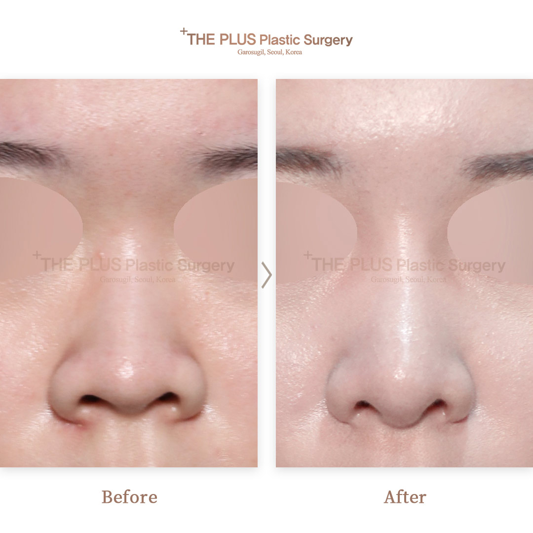 THE PLUS CLINIC KOREA -