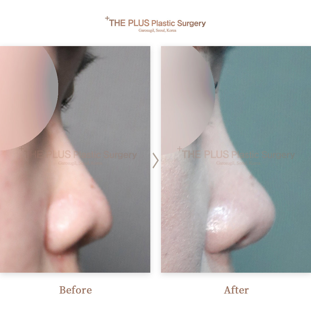 THE PLUS CLINIC KOREA -