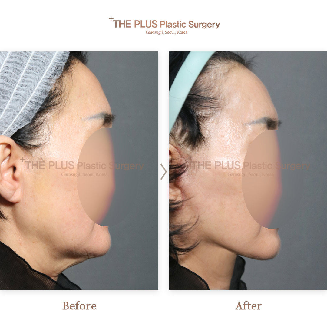 THE PLUS CLINIC KOREA -