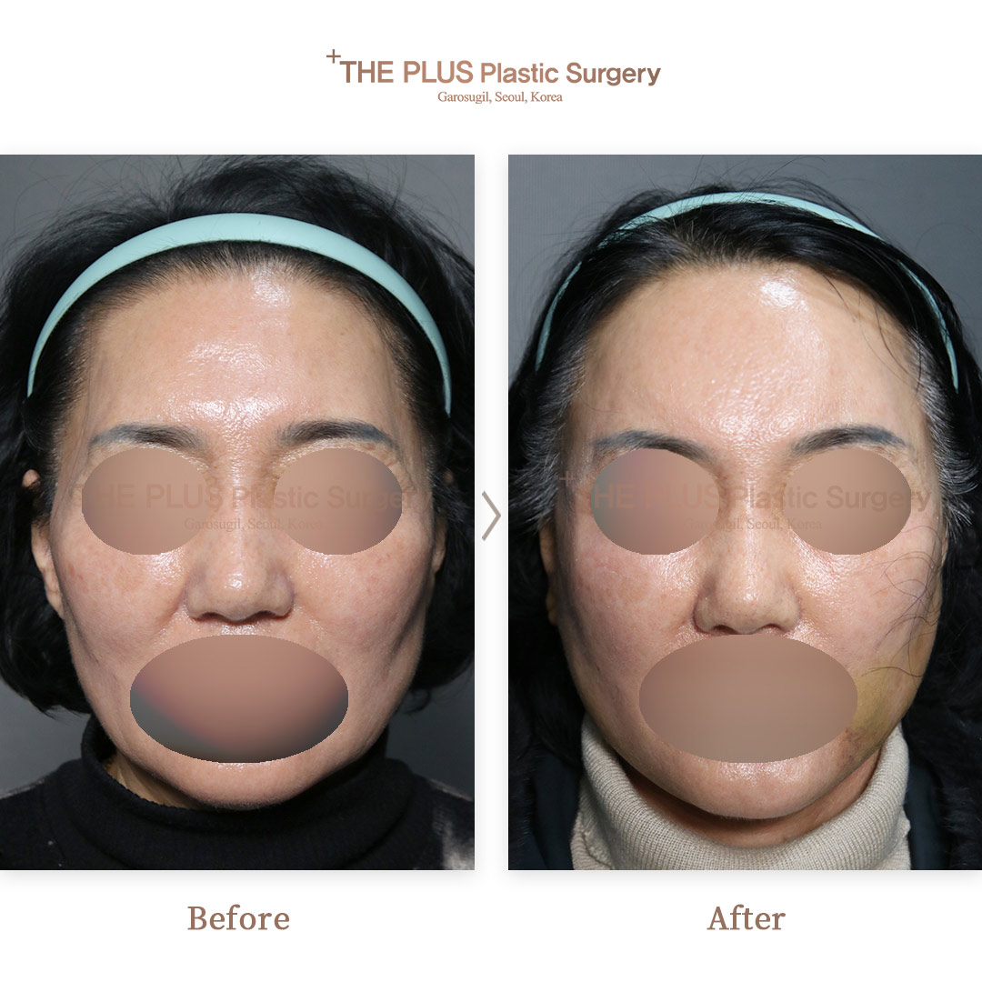 THE PLUS CLINIC KOREA -
