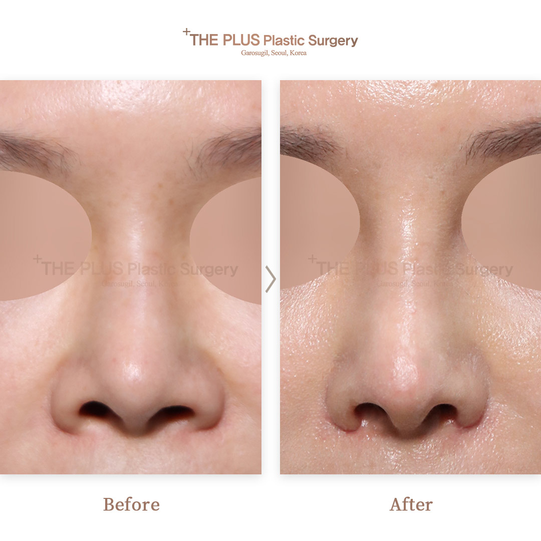 THE PLUS CLINIC KOREA -