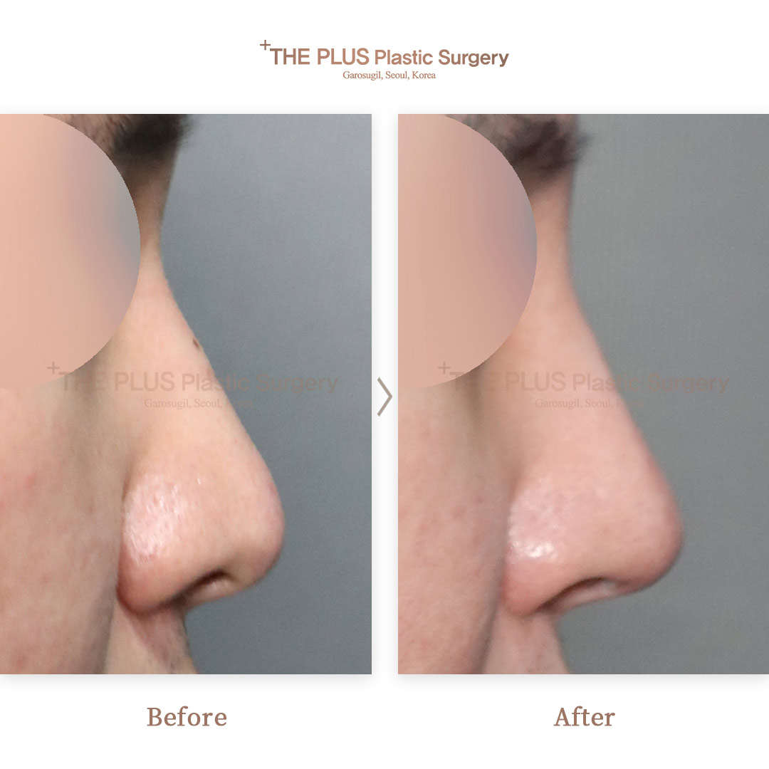 THE PLUS CLINIC KOREA -