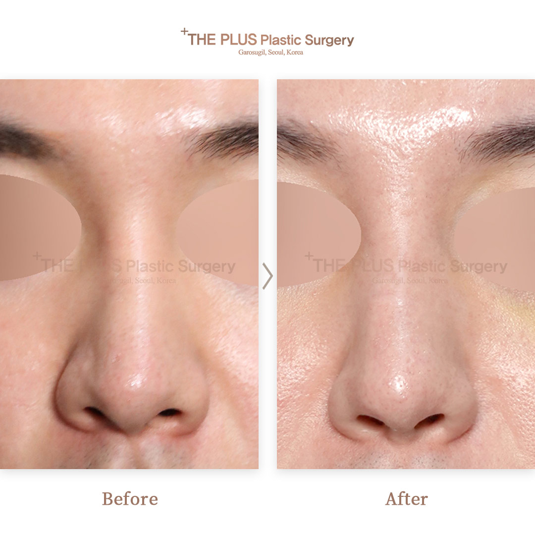 THE PLUS CLINIC KOREA -