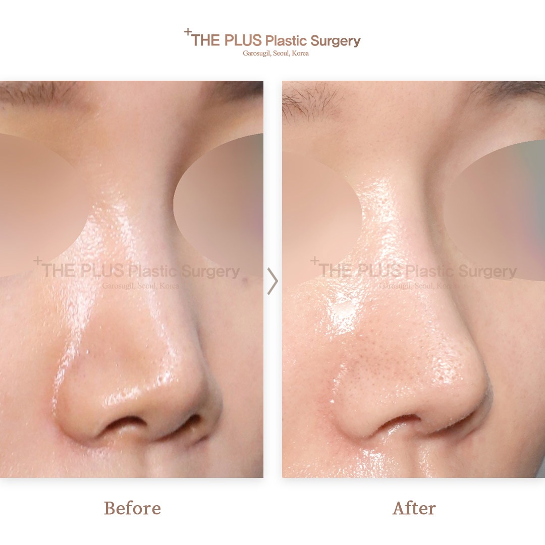THE PLUS CLINIC KOREA -