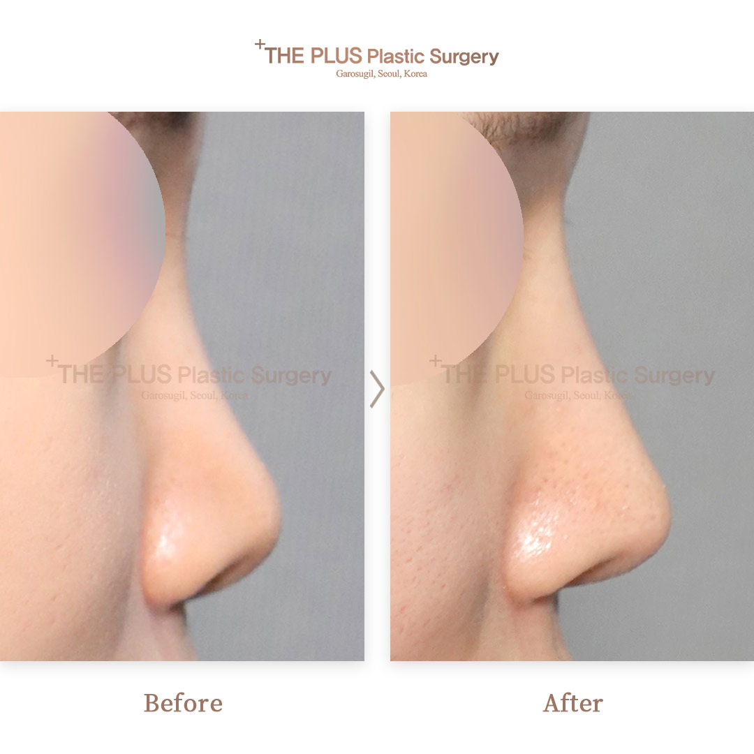 THE PLUS CLINIC KOREA -