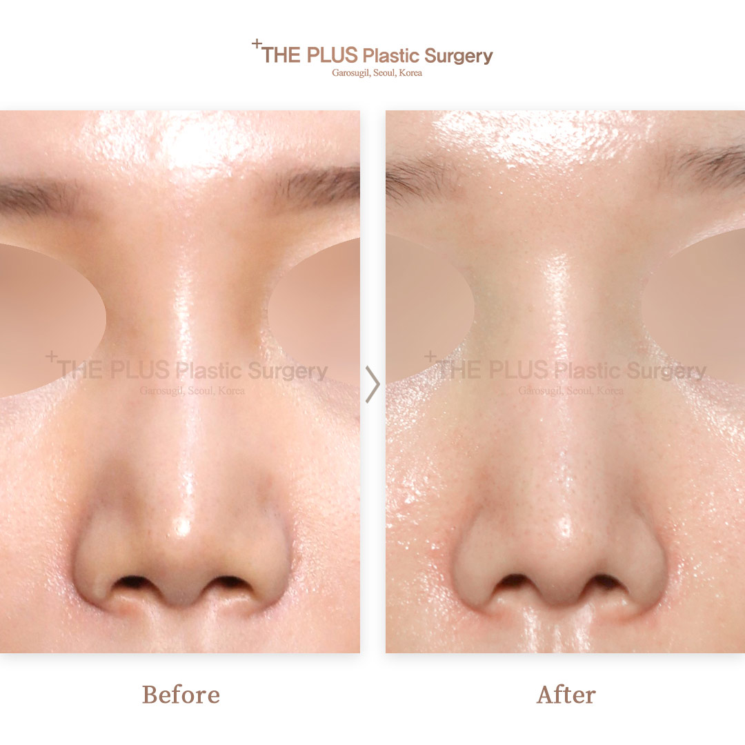 THE PLUS CLINIC KOREA -