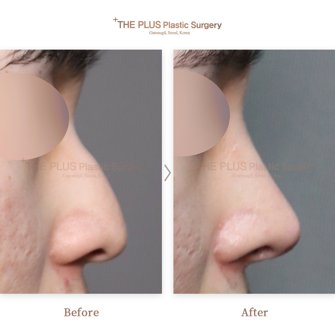 THE PLUS CLINIC KOREA -