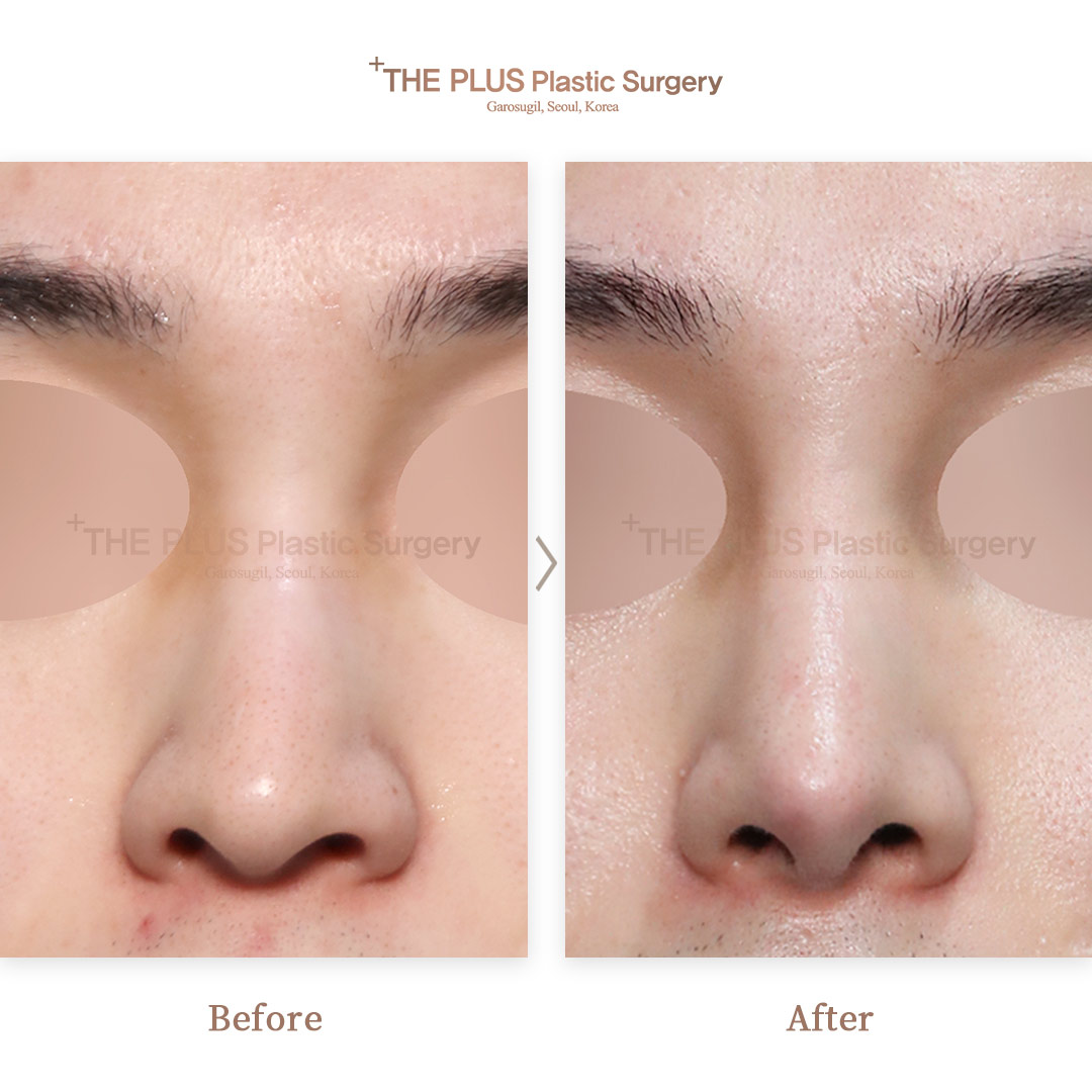 THE PLUS CLINIC KOREA -