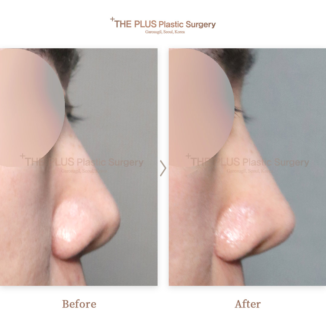 THE PLUS CLINIC KOREA -