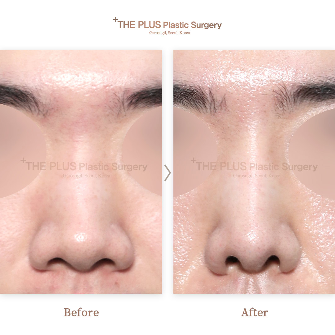 THE PLUS CLINIC KOREA -