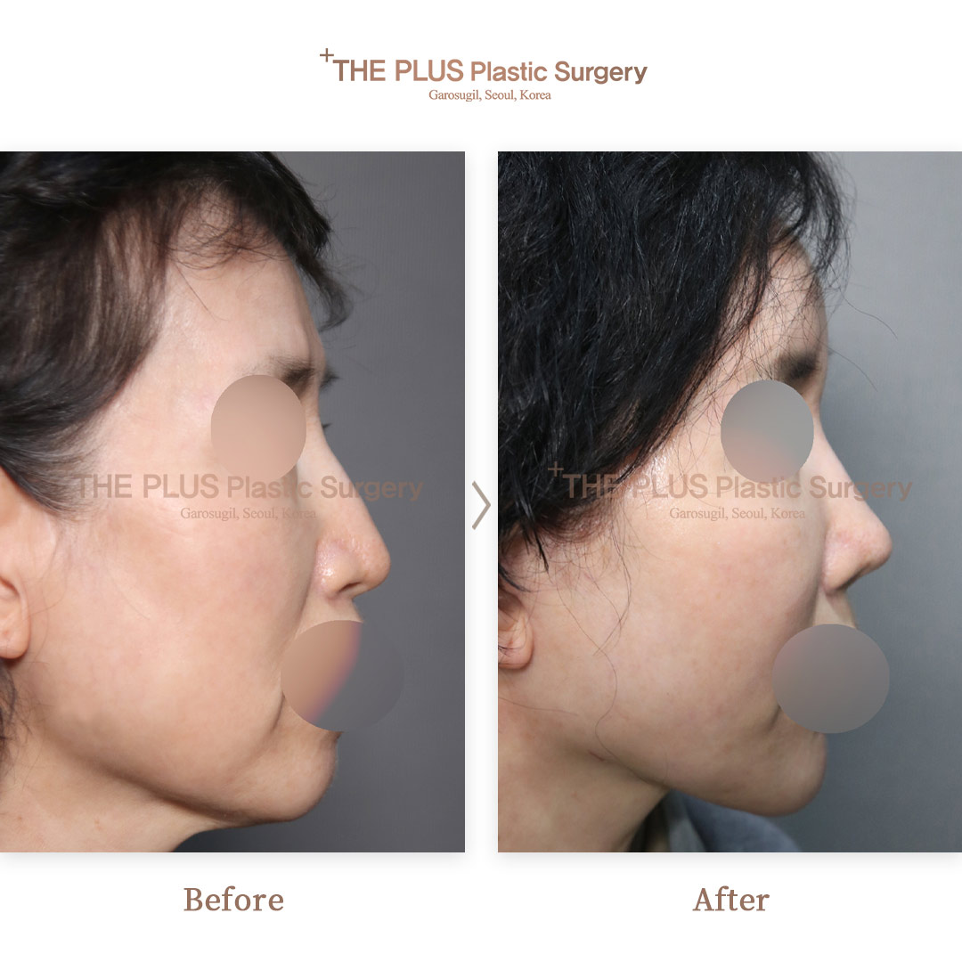 THE PLUS CLINIC KOREA -