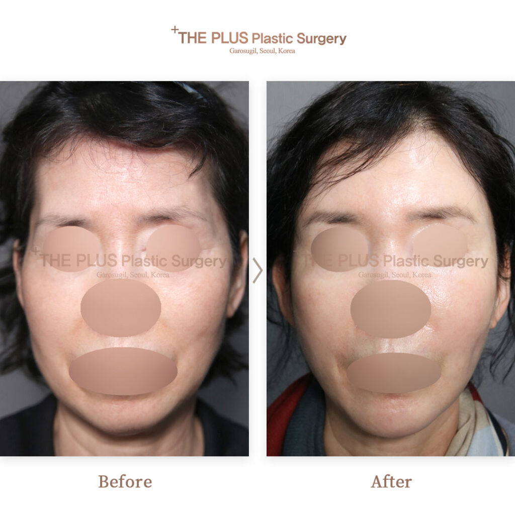 THE PLUS CLINIC KOREA -