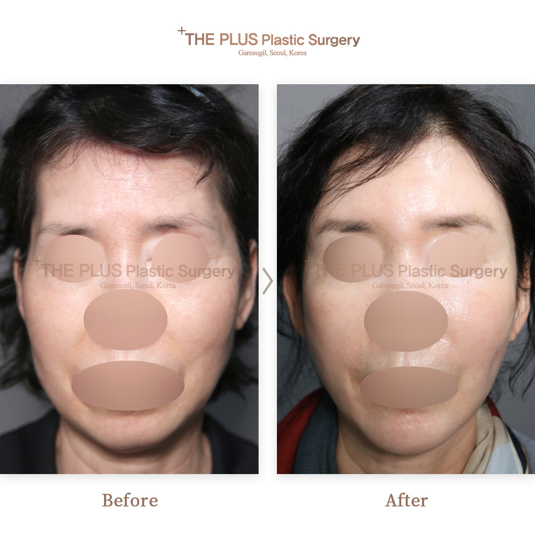 THE PLUS CLINIC KOREA -