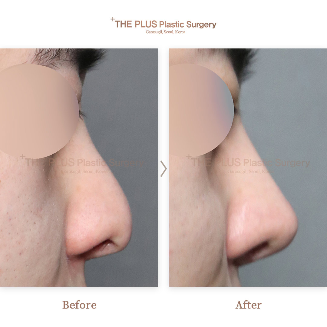 THE PLUS CLINIC KOREA -