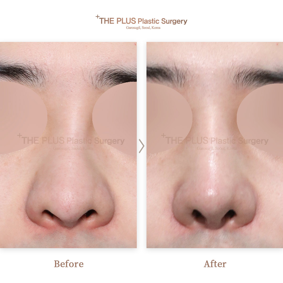 THE PLUS CLINIC KOREA -