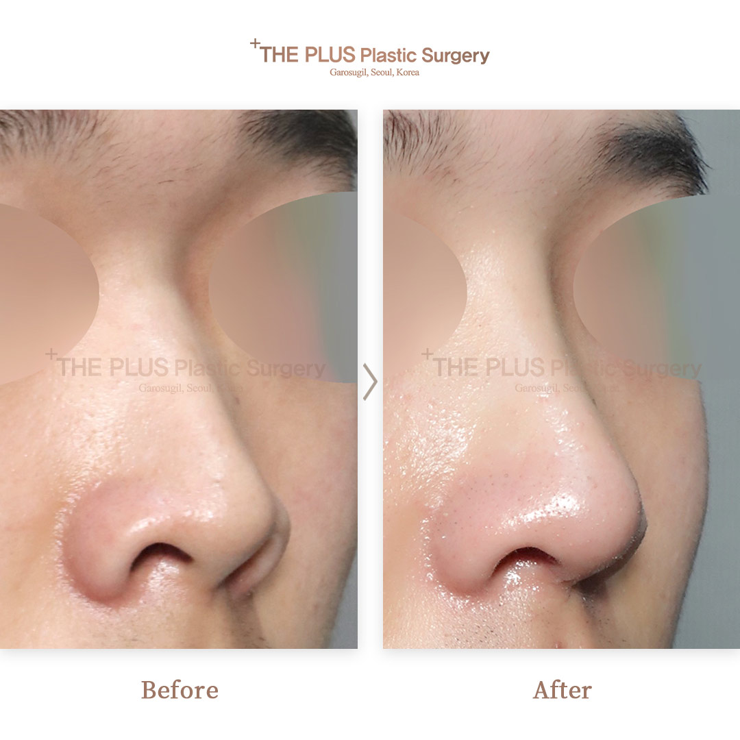 THE PLUS CLINIC KOREA -