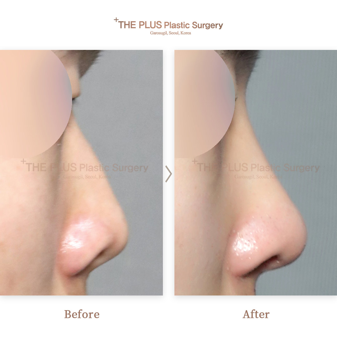 THE PLUS CLINIC KOREA -