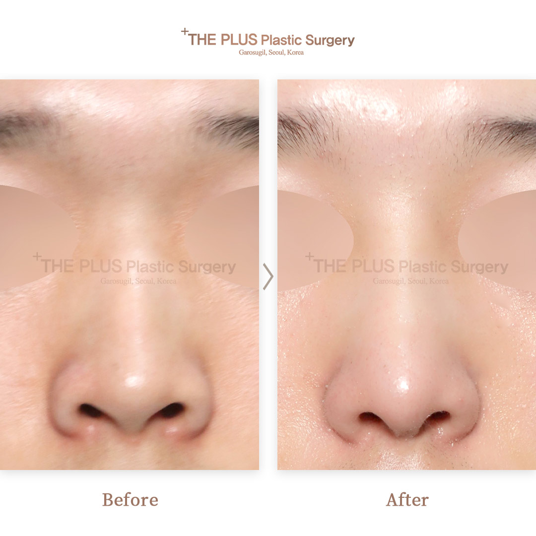 THE PLUS CLINIC KOREA -