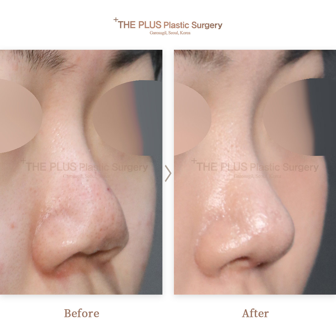 THE PLUS CLINIC KOREA -