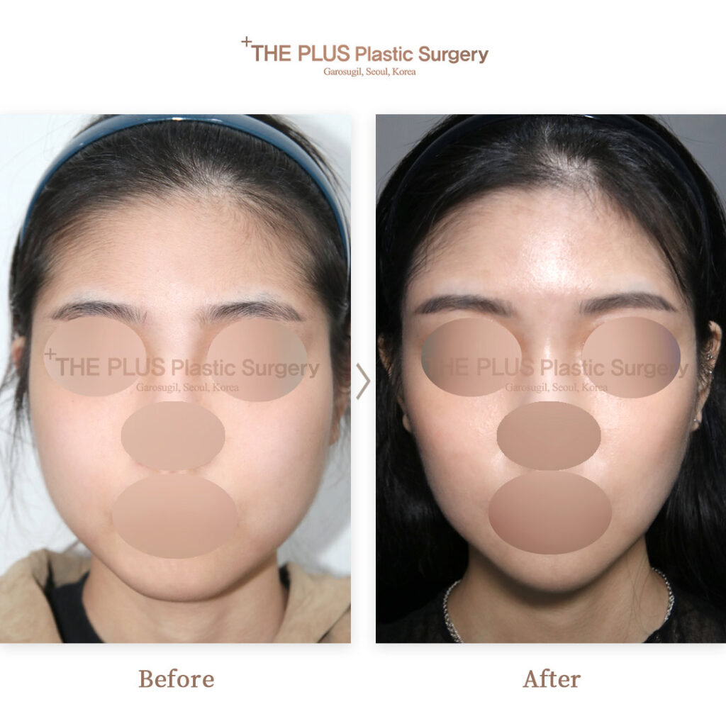 THE PLUS CLINIC KOREA -