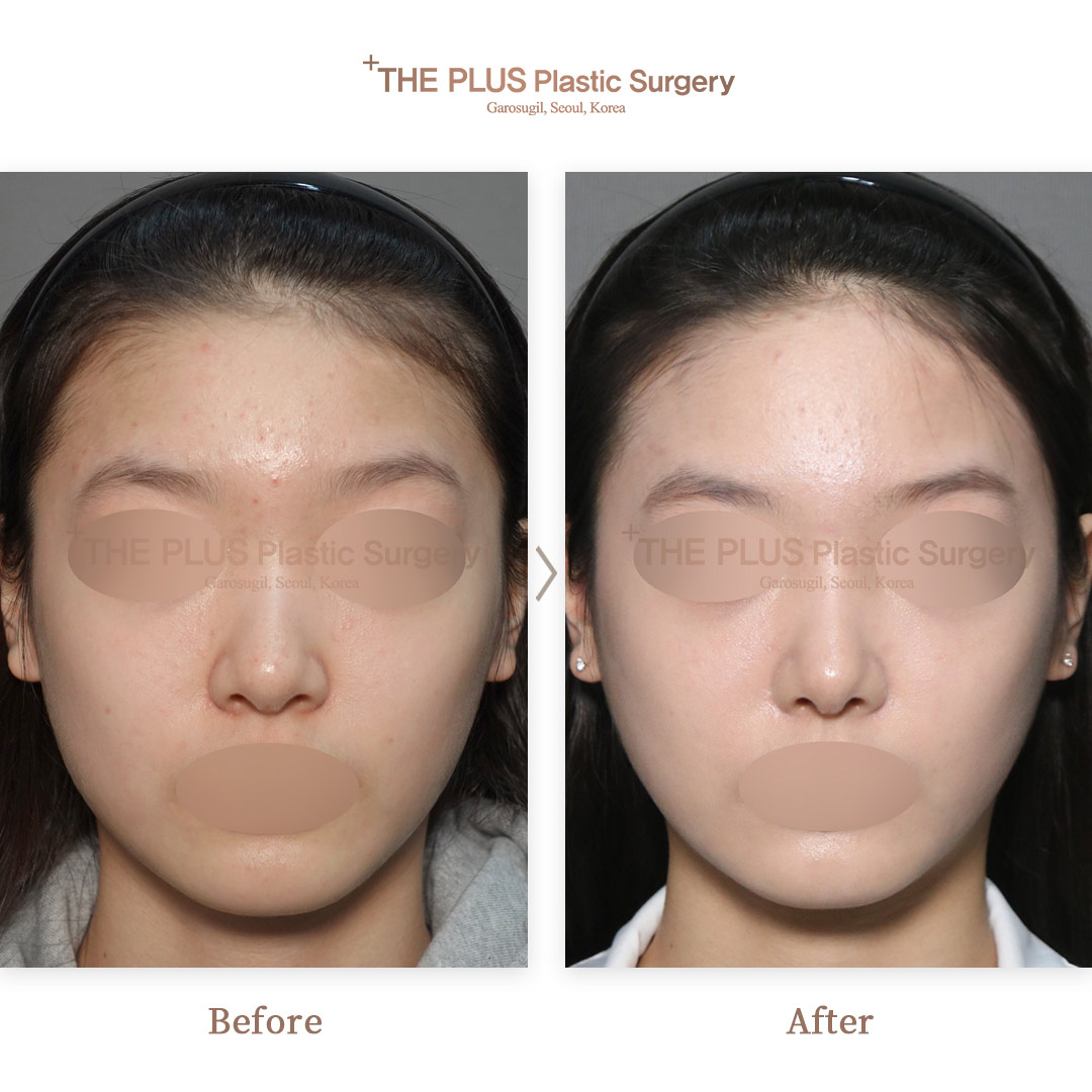 THE PLUS CLINIC KOREA -