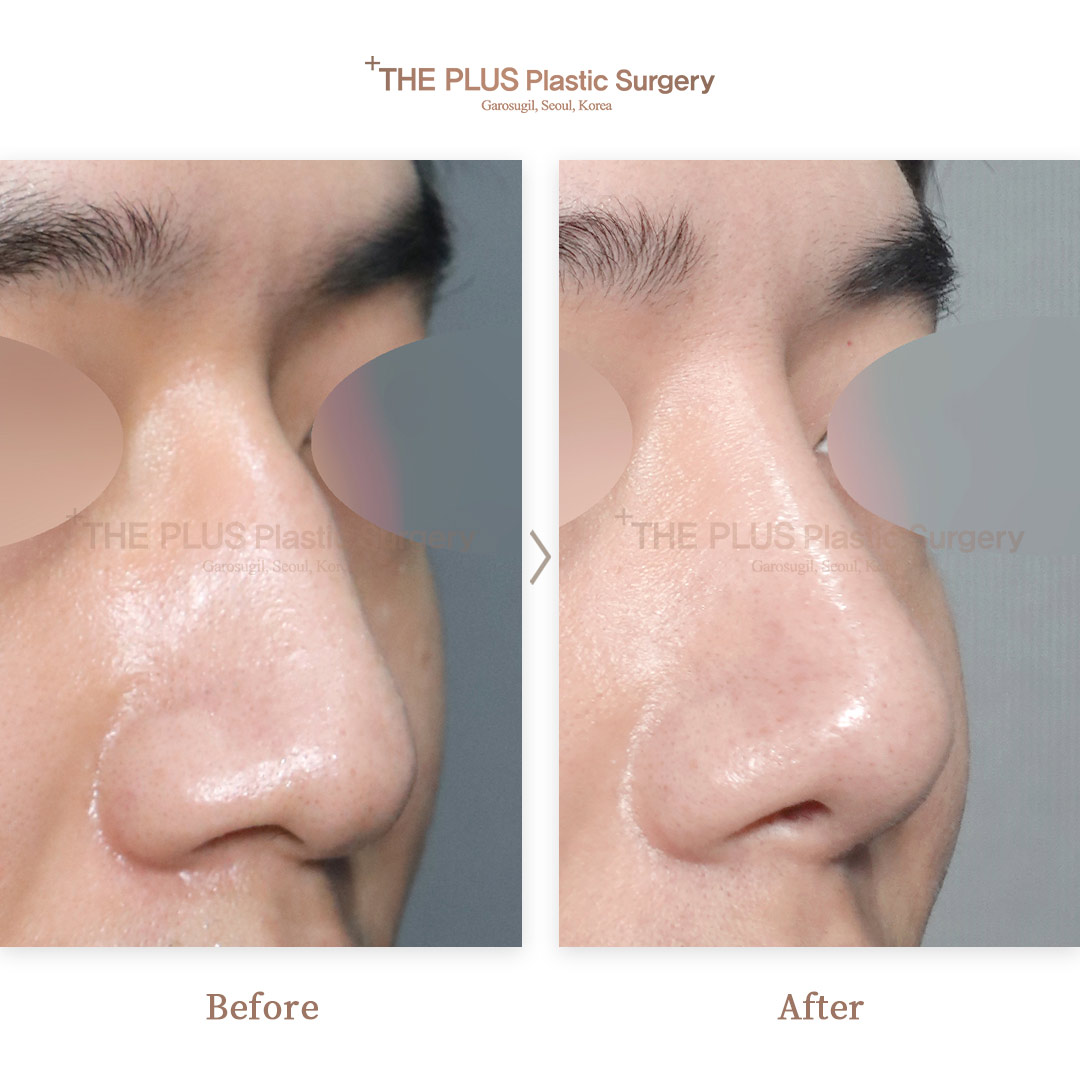 THE PLUS CLINIC KOREA -
