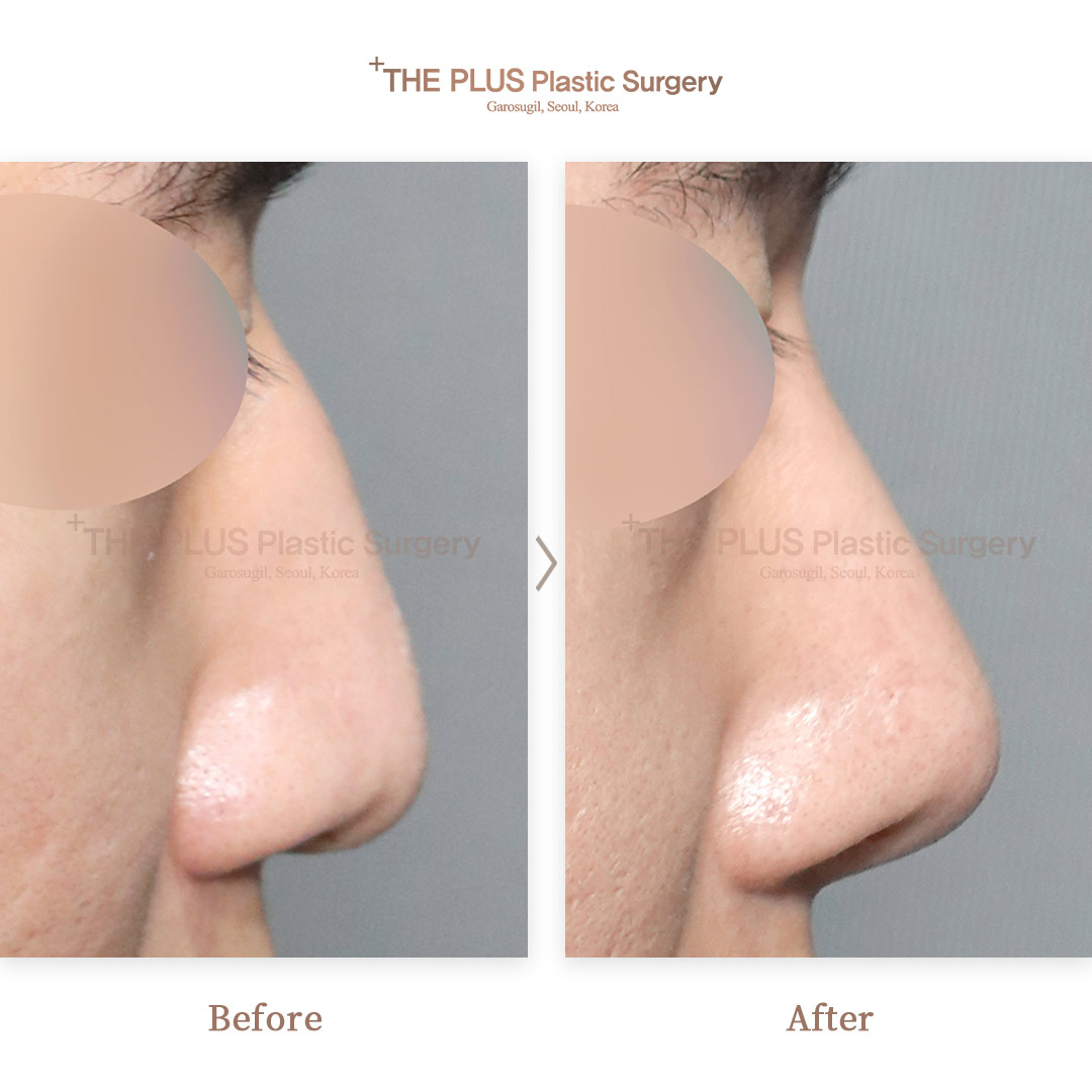 THE PLUS CLINIC KOREA -