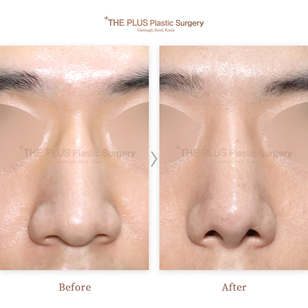 THE PLUS CLINIC KOREA -