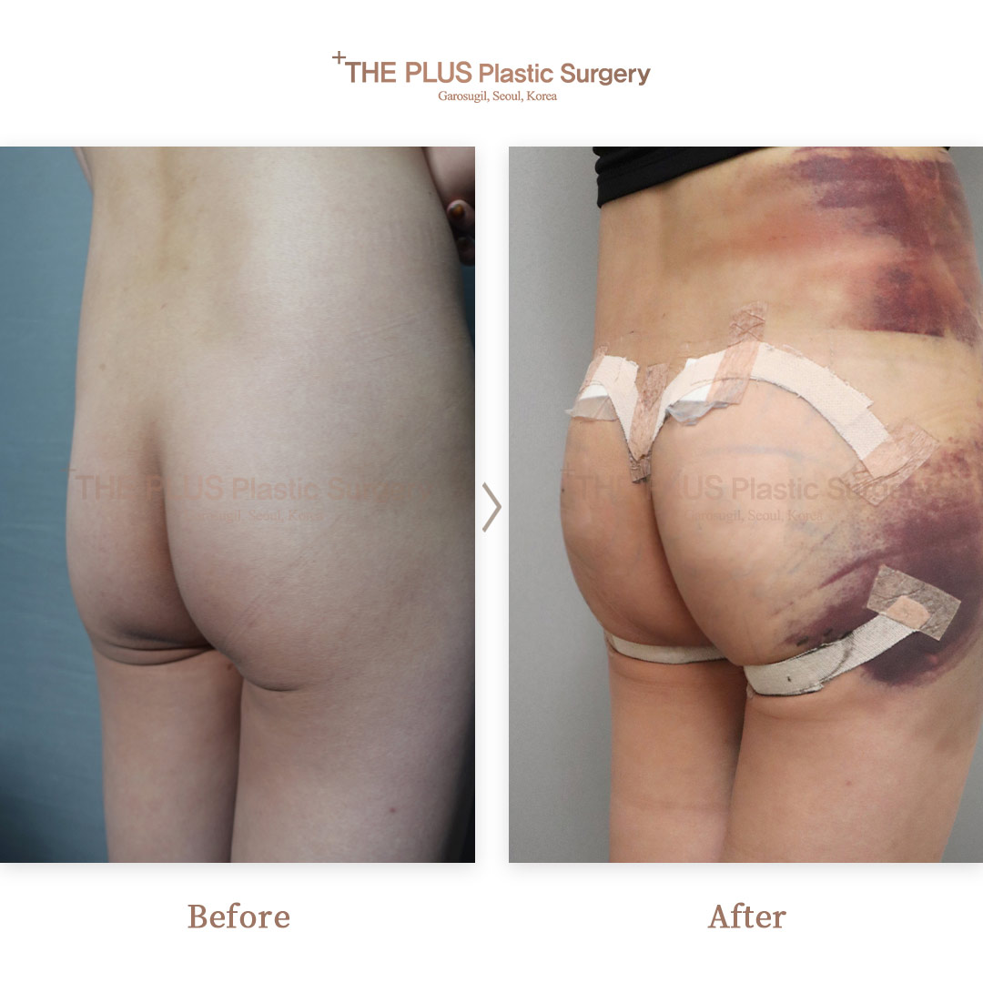 THE PLUS CLINIC KOREA -