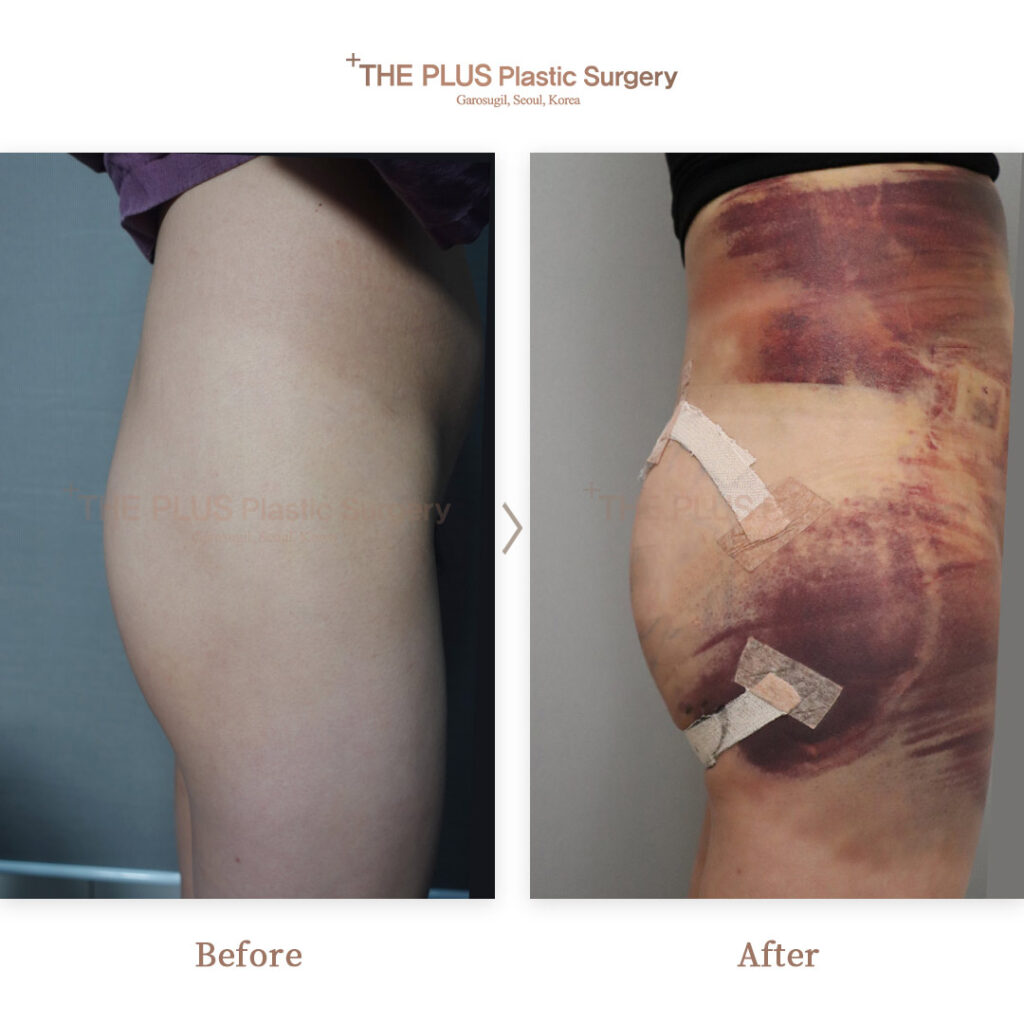 THE PLUS CLINIC KOREA -