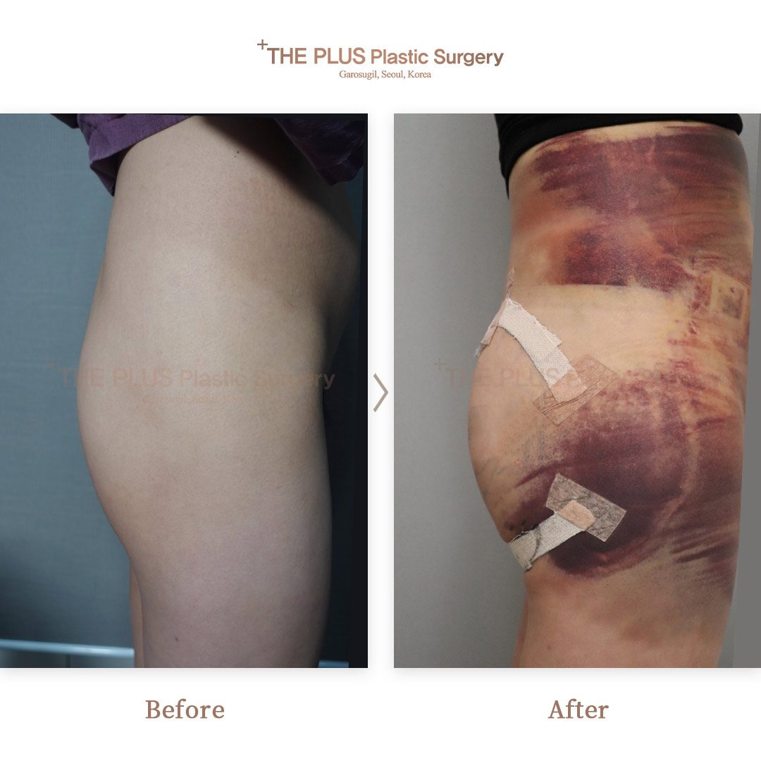 THE PLUS CLINIC KOREA -