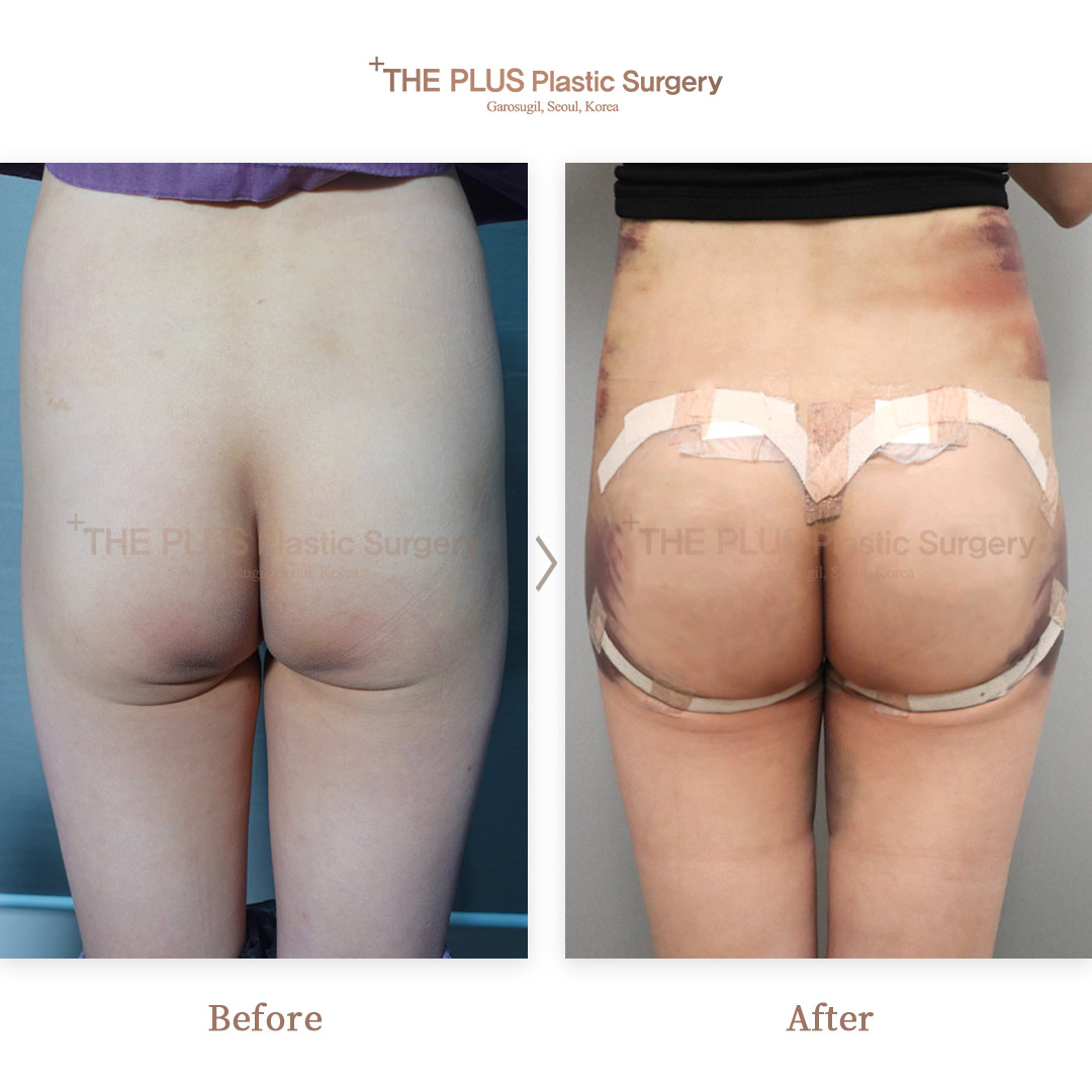 THE PLUS CLINIC KOREA -
