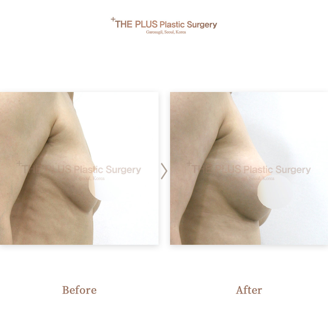 THE PLUS CLINIC KOREA -