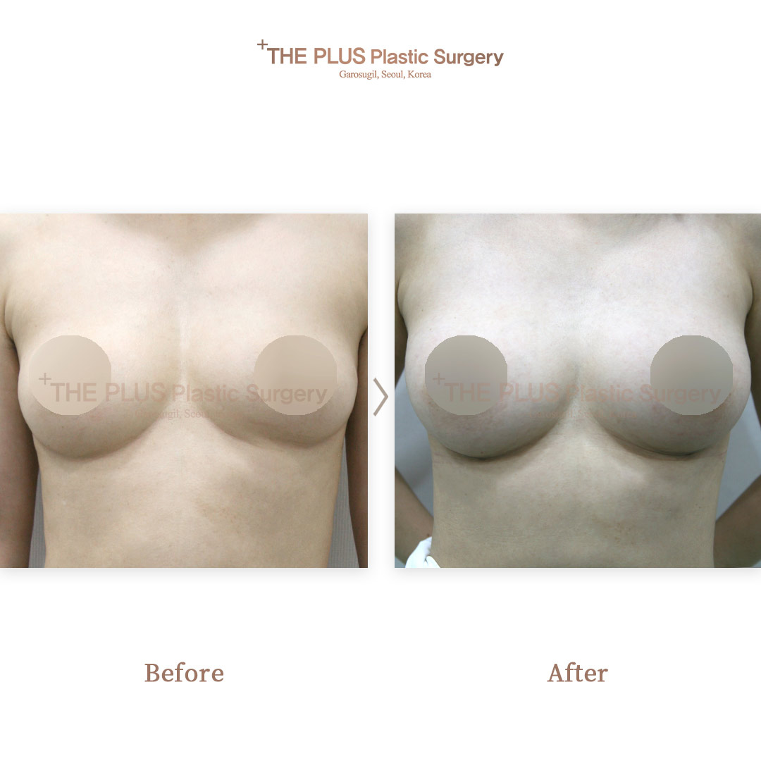 THE PLUS CLINIC KOREA -