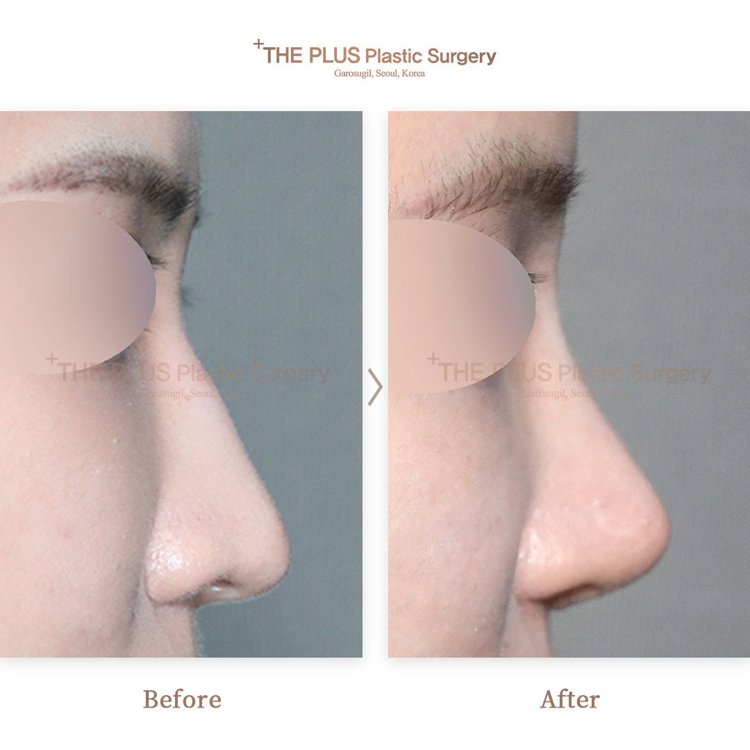 THE PLUS CLINIC KOREA -