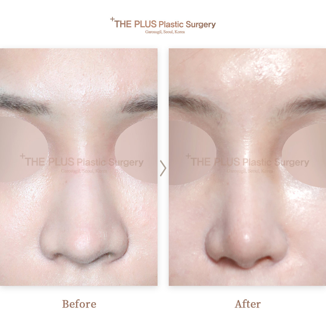 THE PLUS CLINIC KOREA -