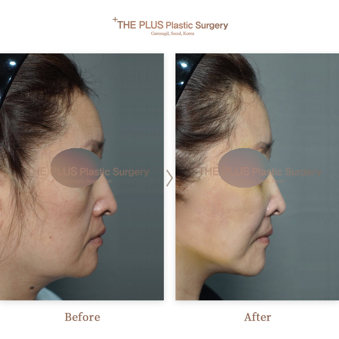 THE PLUS CLINIC KOREA -