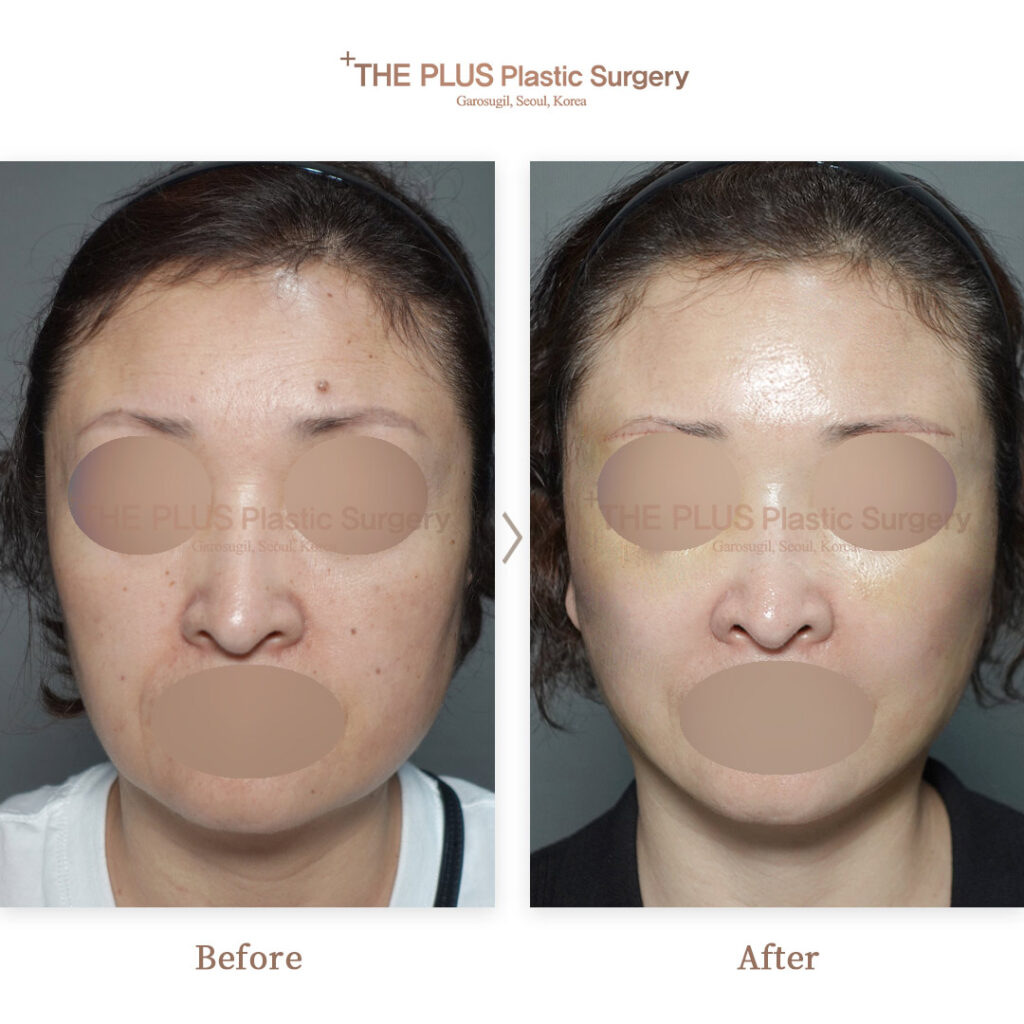 THE PLUS CLINIC KOREA -
