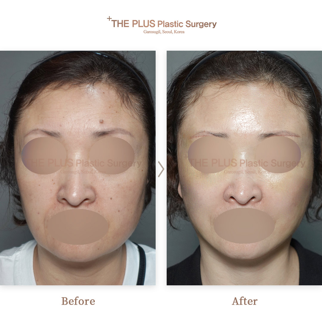 THE PLUS CLINIC KOREA -